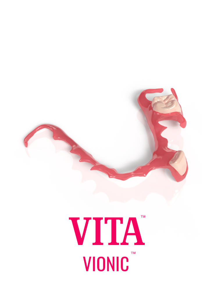 Vita Vionic Split File Removable Partial Denture - Stayplate